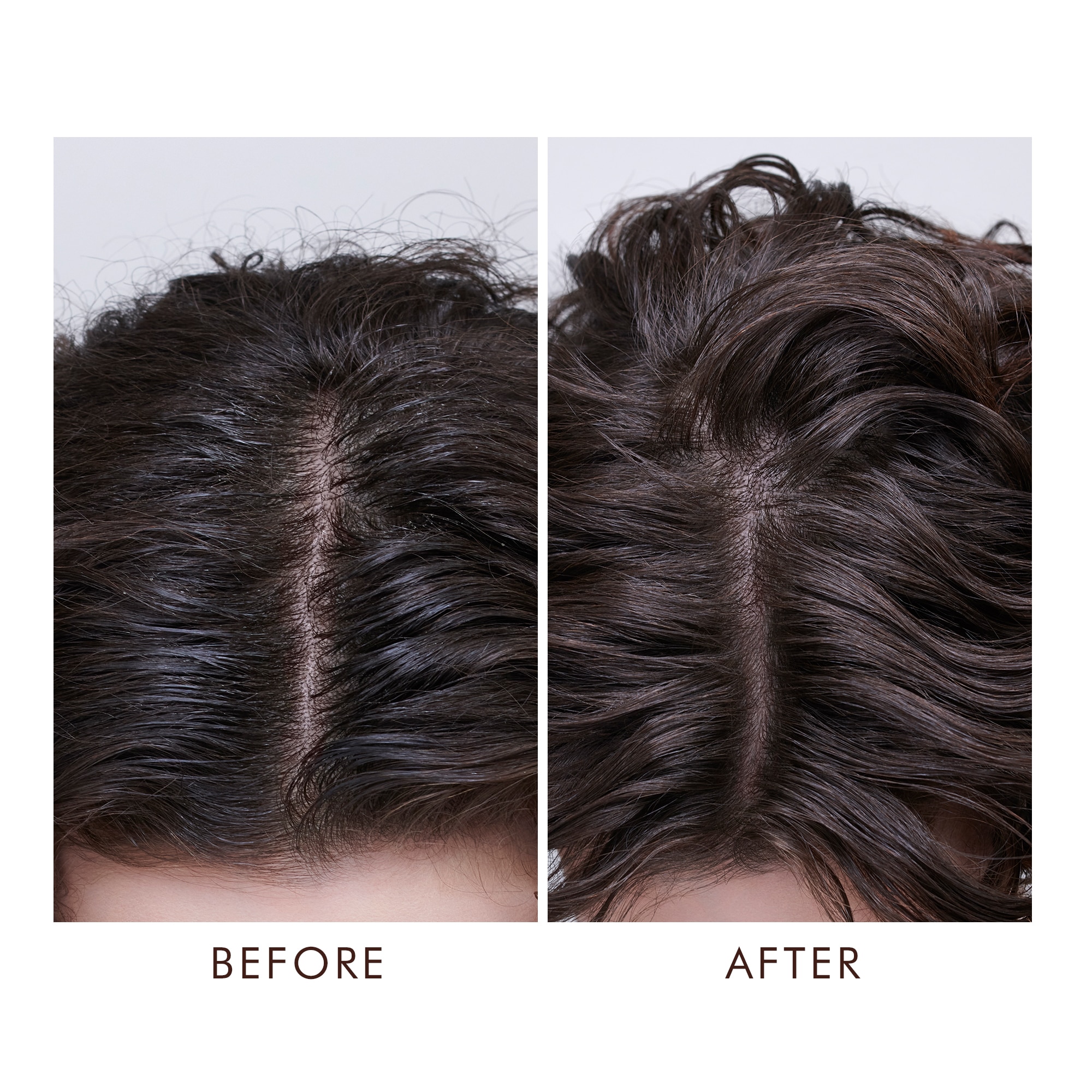 OILY SCALP TREATMENT (SUERO PARA CABELLO)